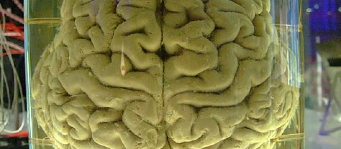 Brain_Wiki